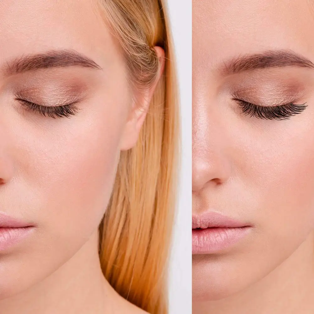 qualash opinie  przed po